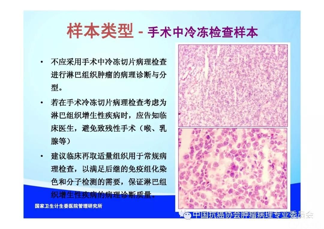 肿瘤病理规范化诊断标准 第2部分:淋巴组织肿瘤病理诊断标准
