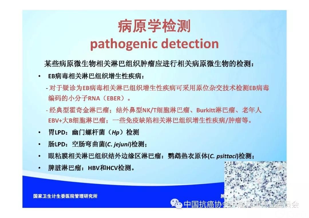 肿瘤病理规范化诊断标准 第2部分:淋巴组织肿瘤病理诊断标准