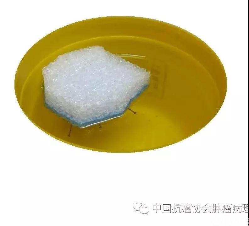 图1内镜下黏膜切除术/内镜下黏膜剥脱术标本固定示意图