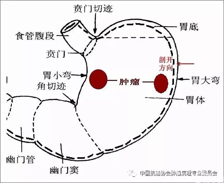 图2 标本固定前剖开示意图