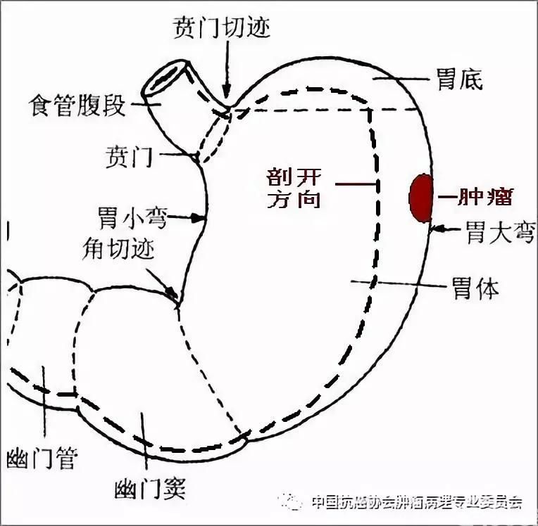 图2 标本固定前剖开示意图