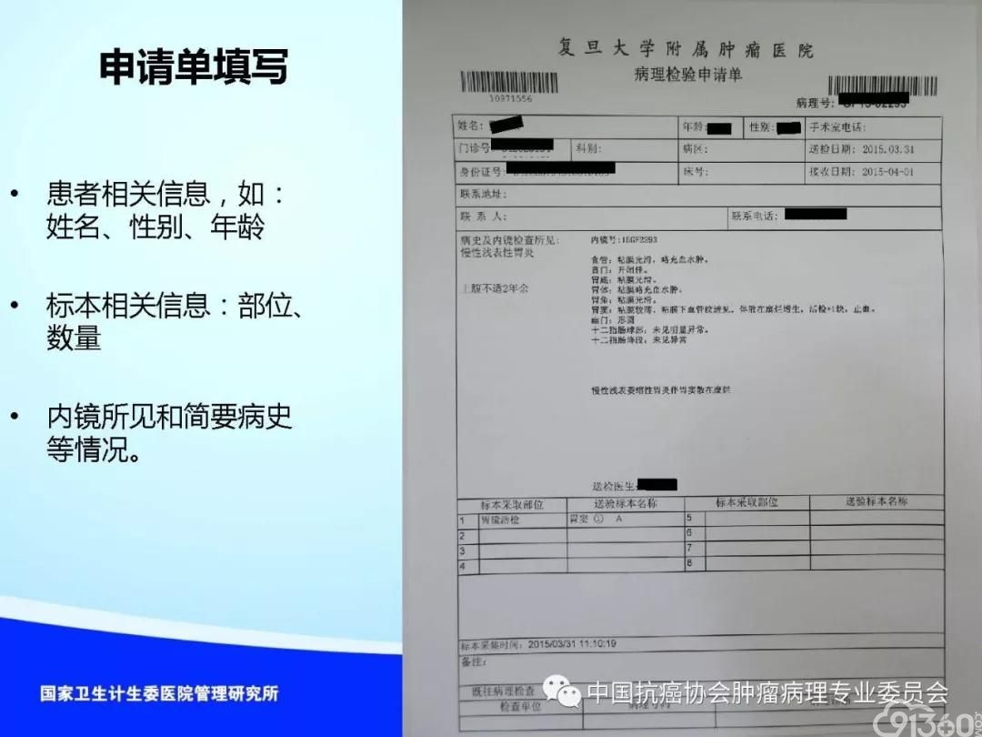 肿瘤病理规范化诊断标准 第4部分:胃癌病理诊断标准