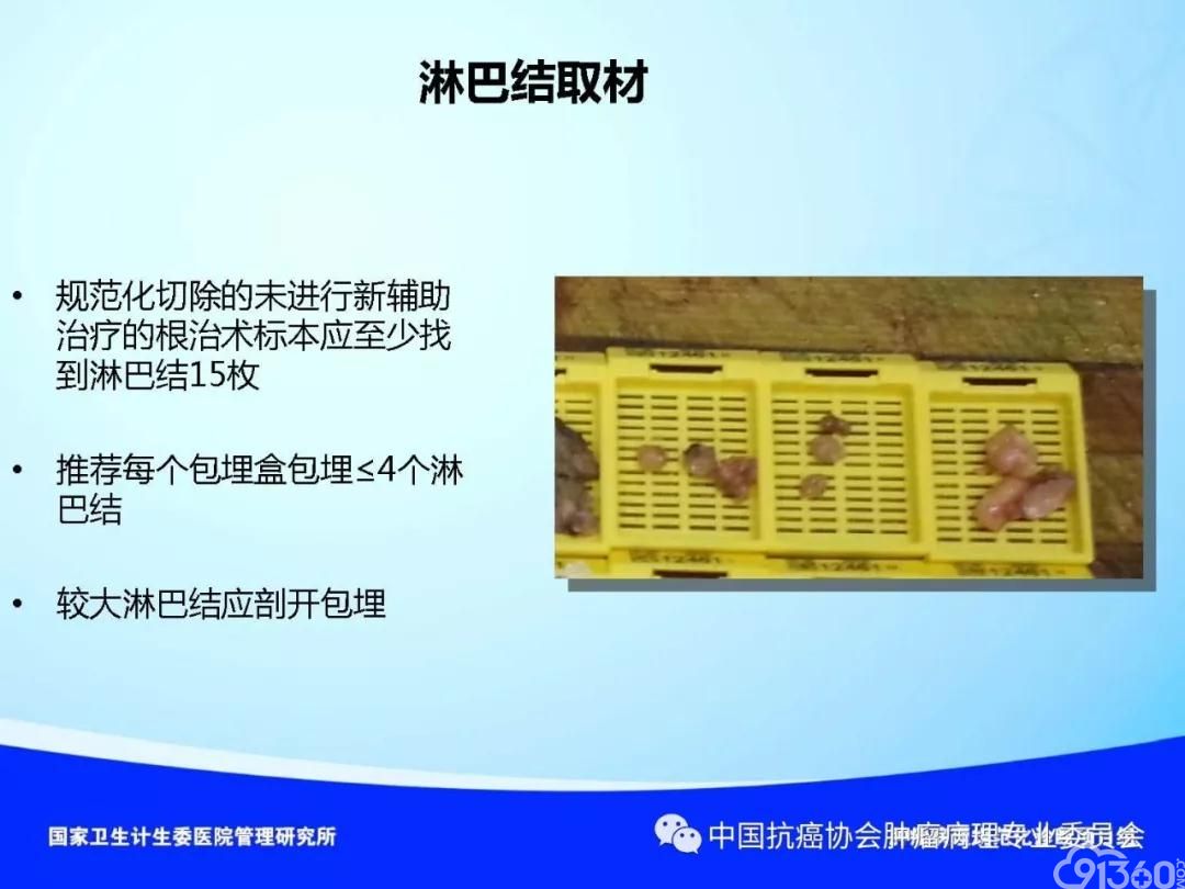 肿瘤病理规范化诊断标准 第4部分:胃癌病理诊断标准