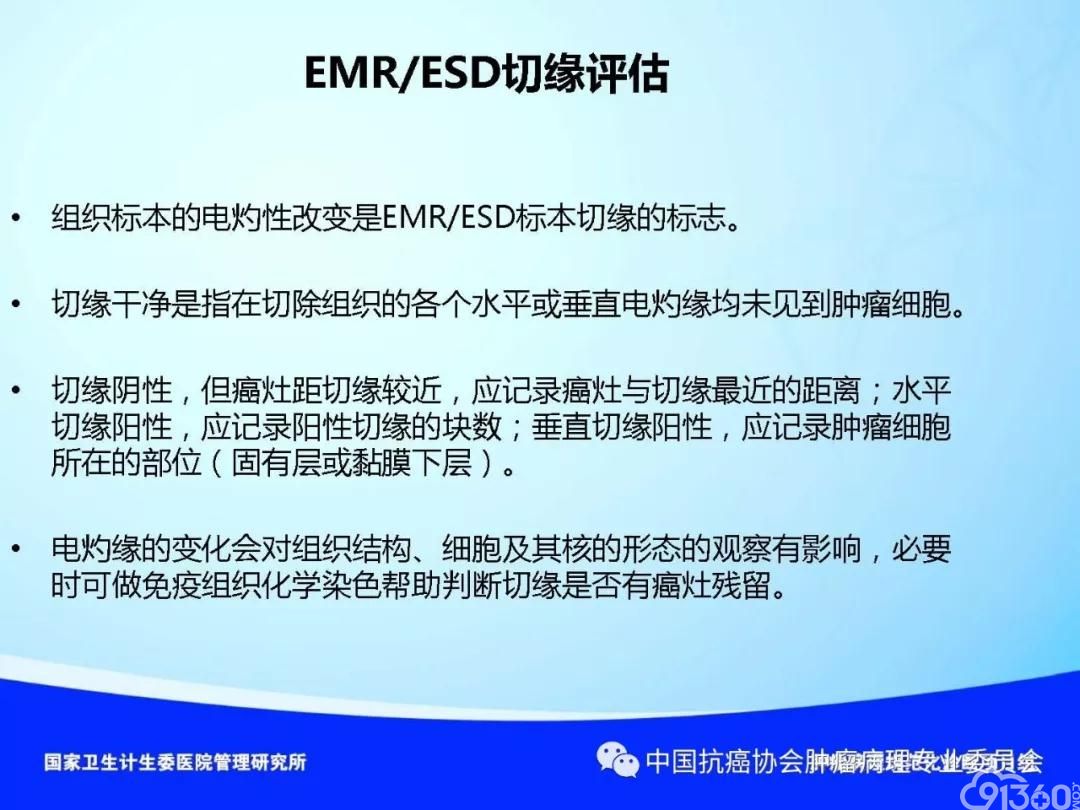 肿瘤病理规范化诊断标准 第4部分:胃癌病理诊断标准