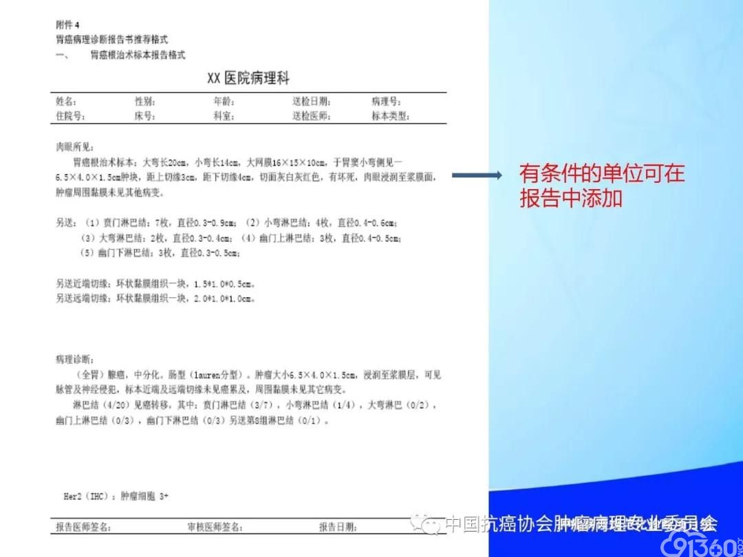 肿瘤病理规范化诊断标准 第4部分:胃癌病理诊断标准
