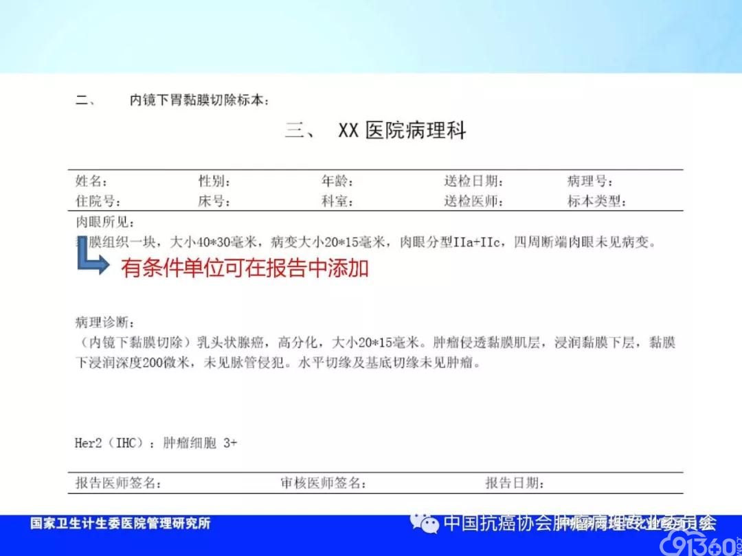 肿瘤病理规范化诊断标准 第4部分:胃癌病理诊断标准