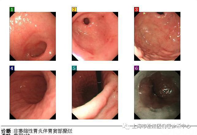 有时一个简单的动作可以解决不少棘手的诊断问题