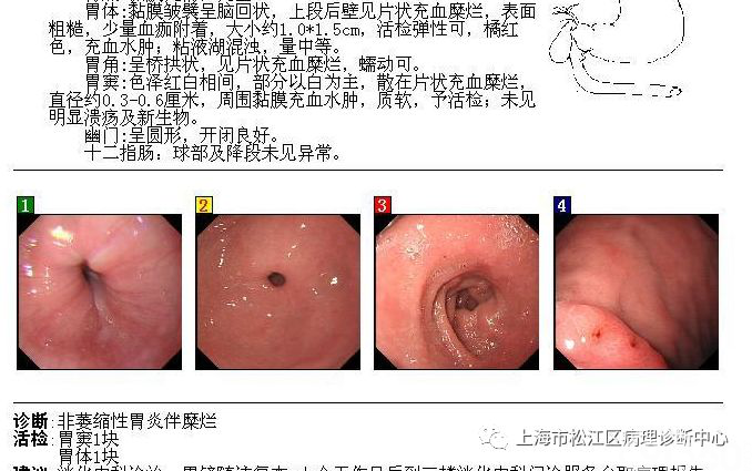 有时一个简单的动作可以解决不少棘手的诊断问题