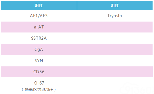 正确率仅为22%,这又是多复杂的案例?!--揭秘福尔摩斯案件九
