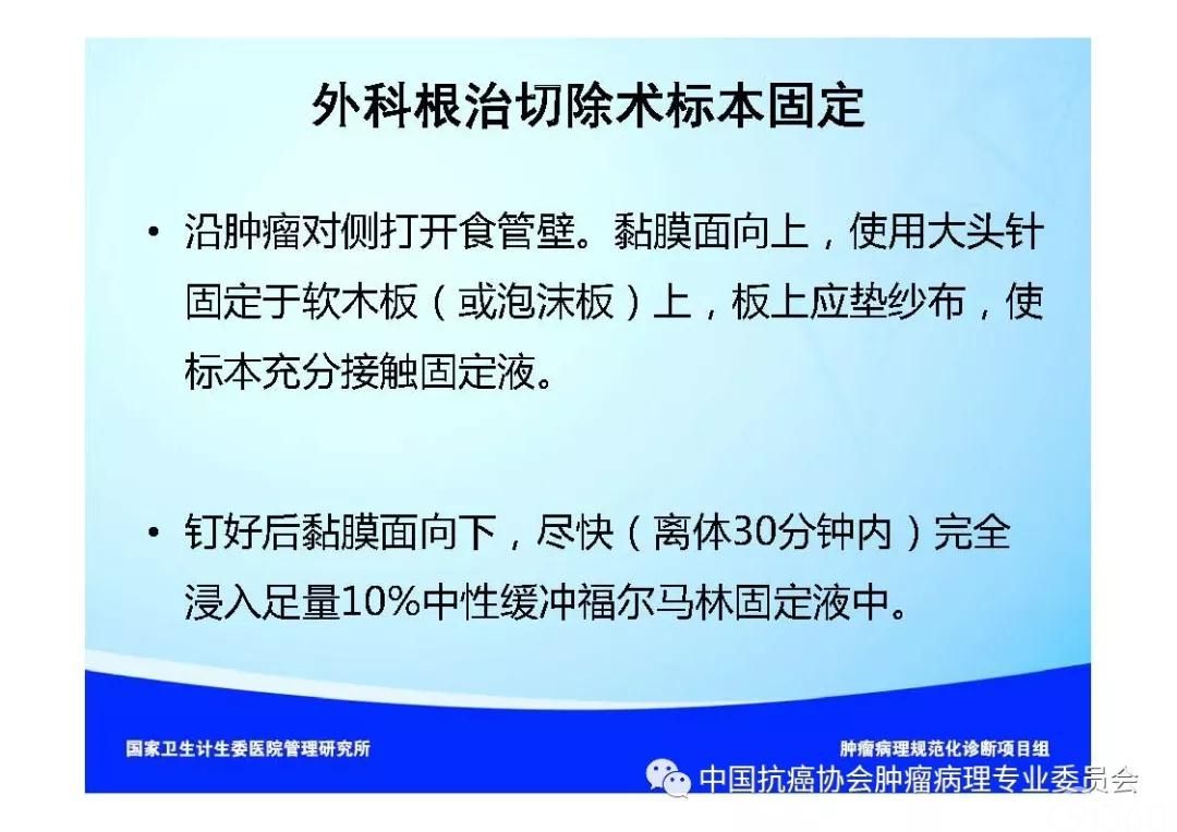 肿瘤病理规范化诊断标准 第7部分:食管癌病理诊断标准