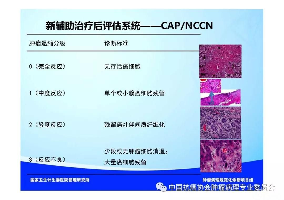 肿瘤病理规范化诊断标准 第7部分:食管癌病理诊断标准