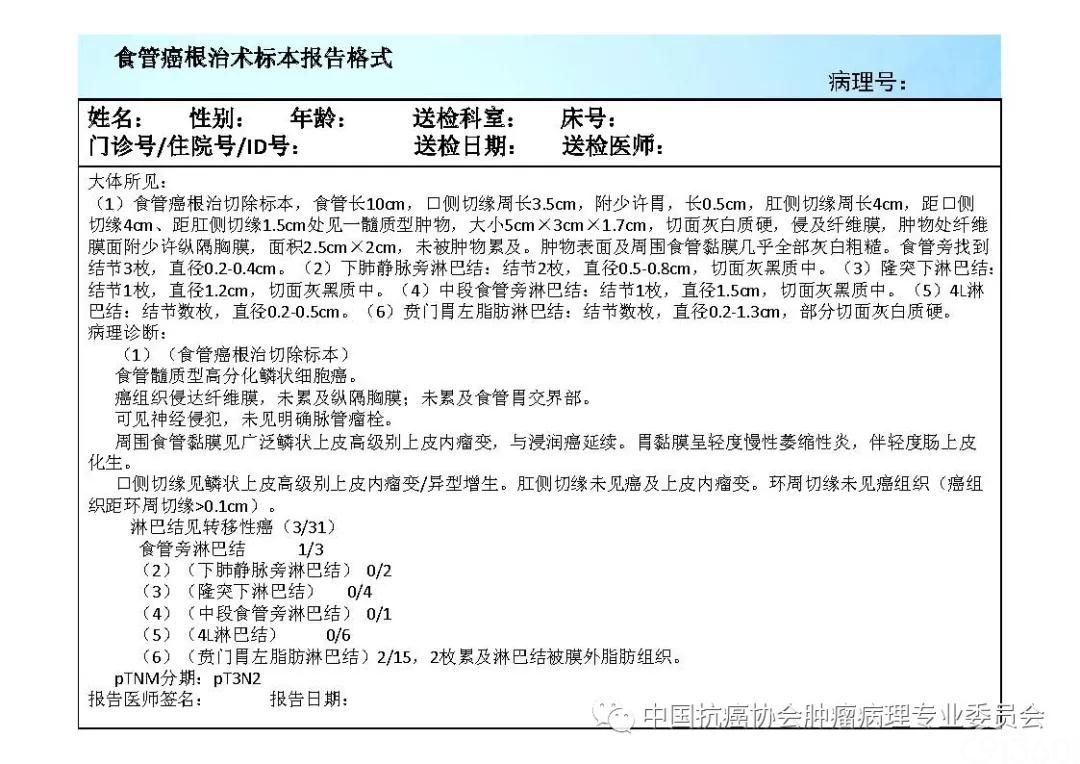 肿瘤病理规范化诊断标准 第7部分:食管癌病理诊断标准