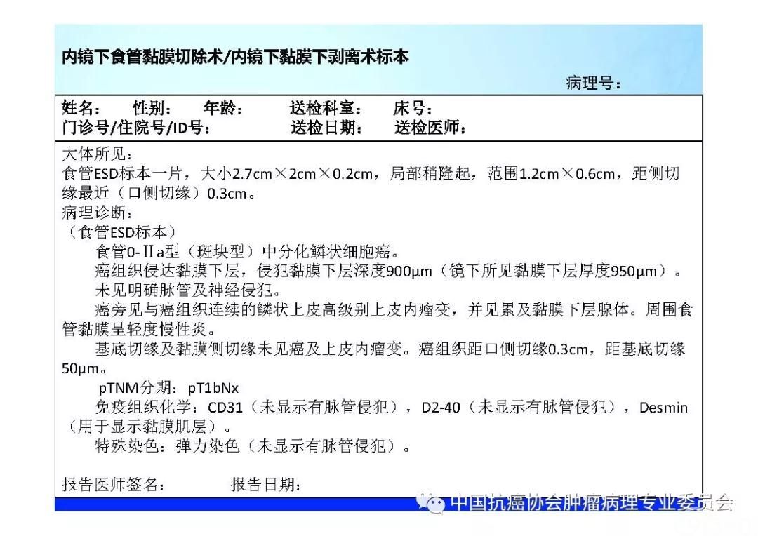肿瘤病理规范化诊断标准 第7部分:食管癌病理诊断标准