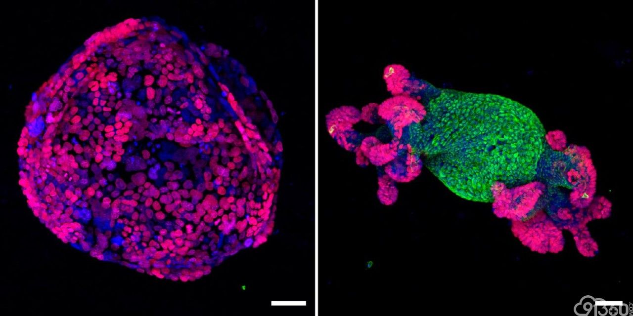 《自然》：科学家首次证实，肿瘤中存在大量与癌症不相关的“吃瓜”杀伤性T细胞，难怪有些患者对免疫治疗没反应 
