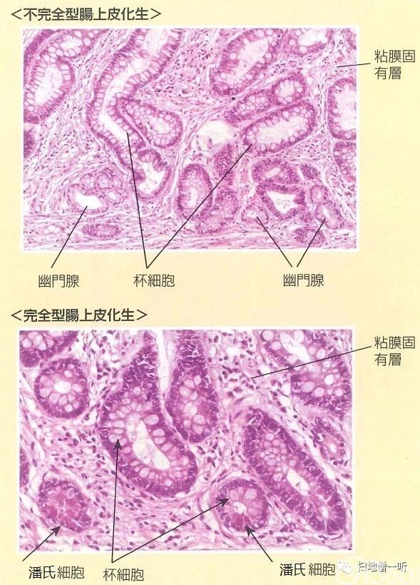 医学美图 胃 肠化の免疫组化基础