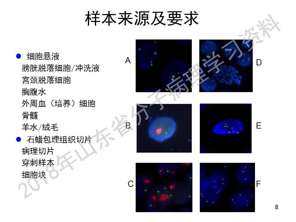 FISH原理及操作判读