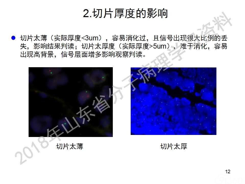 FISH原理及操作判读