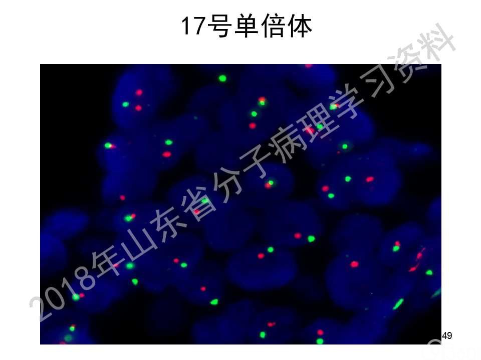 FISH原理及操作判读