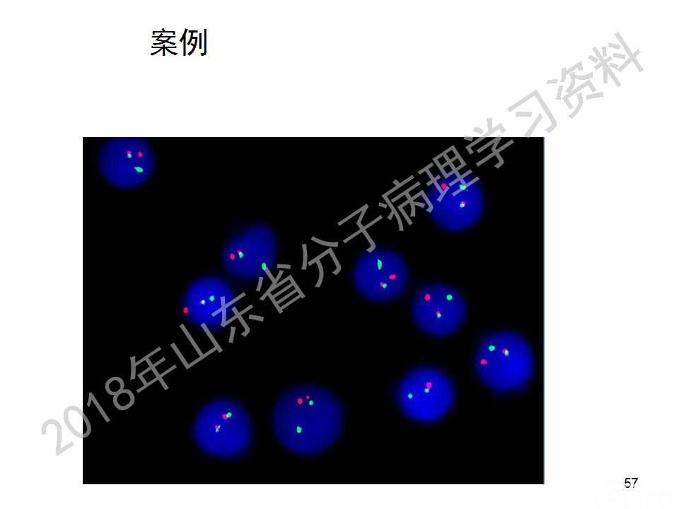 FISH原理及操作判读