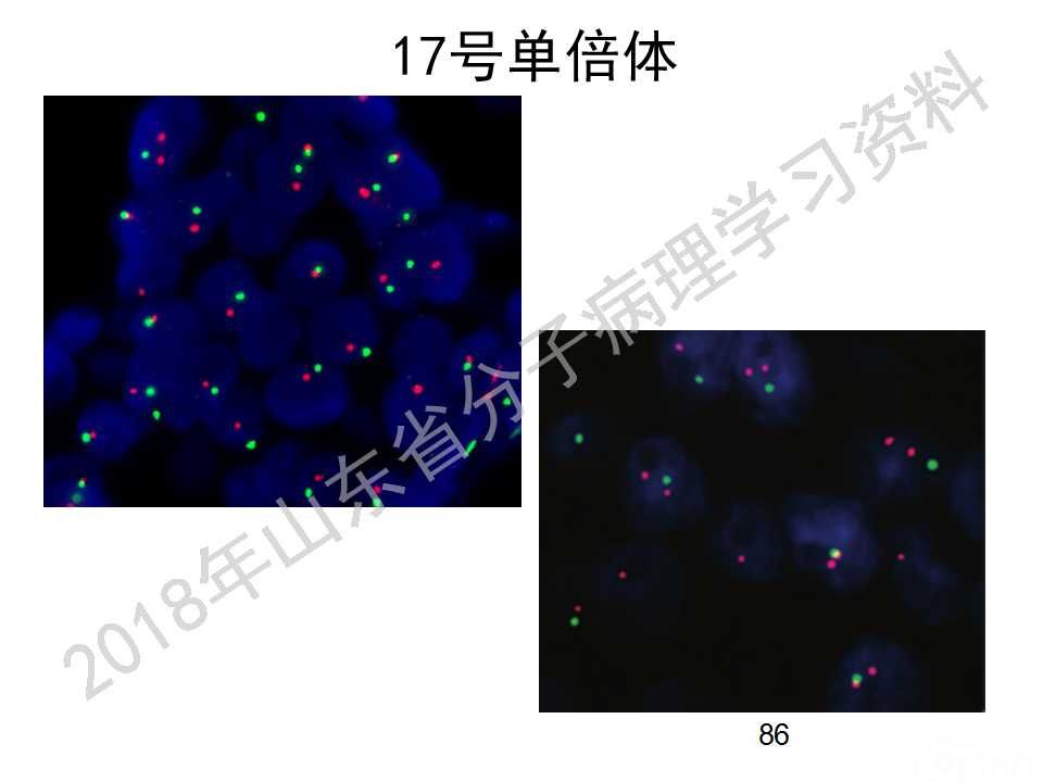 FISH原理及操作判读