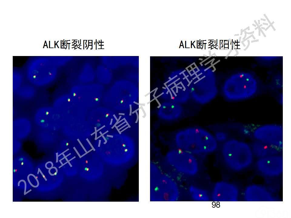 FISH原理及操作判读