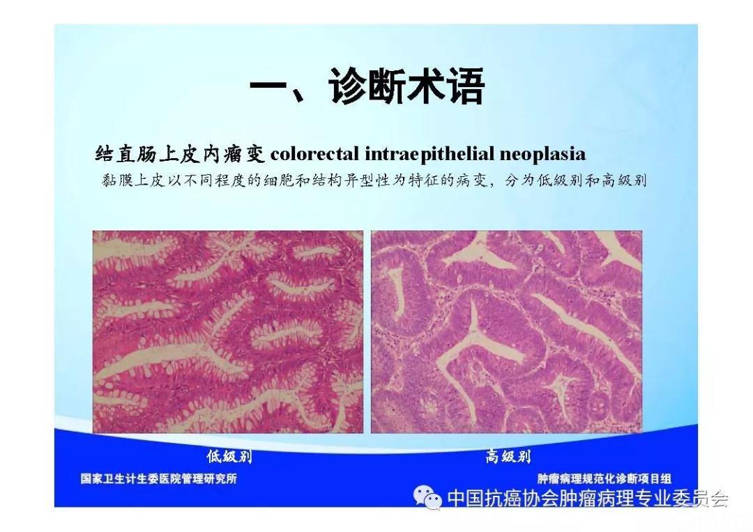 肿瘤病理诊断规范 第9部分:结直肠癌病理诊断规范