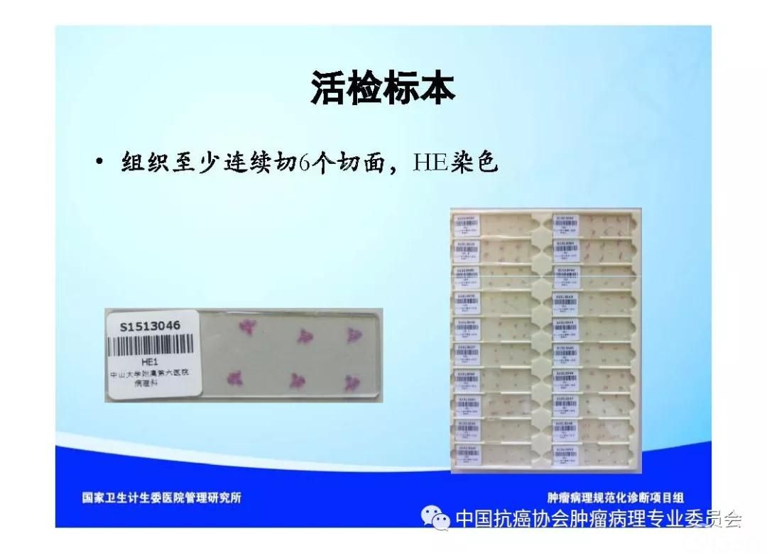 肿瘤病理诊断规范 第9部分:结直肠癌病理诊断规范