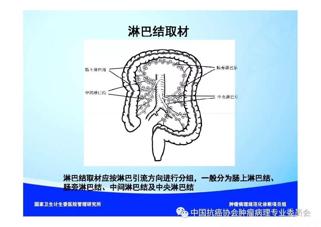 肿瘤病理诊断规范 第9部分:结直肠癌病理诊断规范