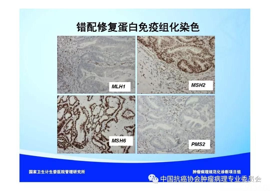 肿瘤病理诊断规范 第9部分:结直肠癌病理诊断规范