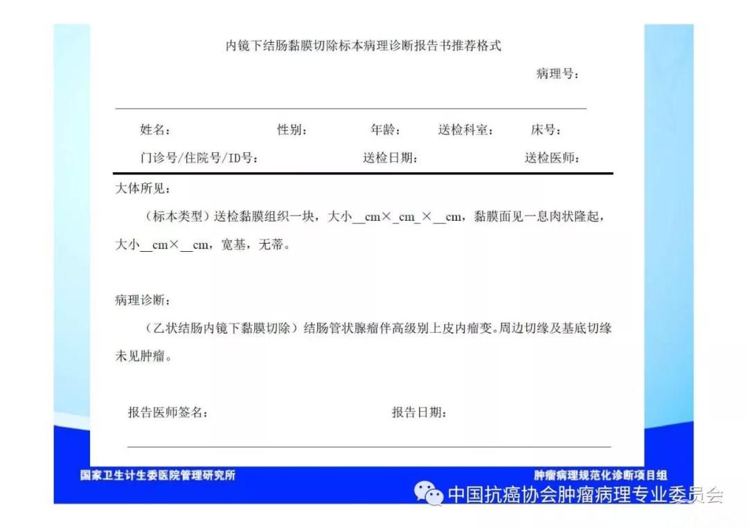 肿瘤病理诊断规范 第9部分:结直肠癌病理诊断规范