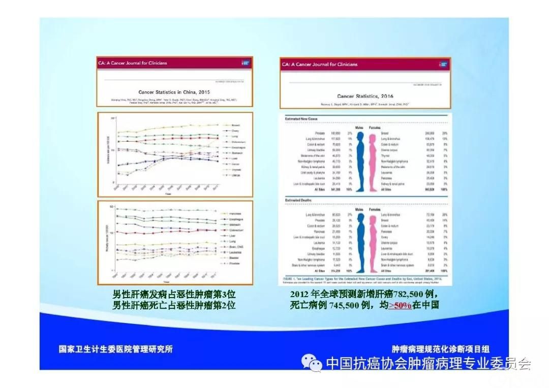 肿瘤病理诊断规范 第8部分:肝癌病理诊断规范