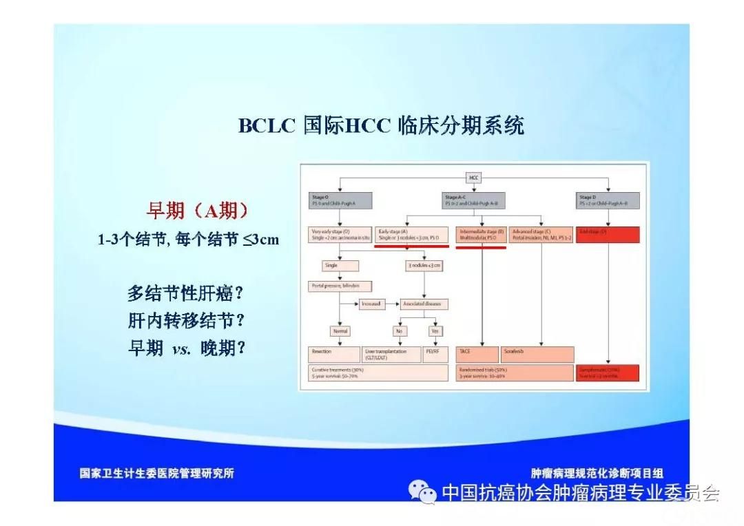 肿瘤病理诊断规范 第8部分:肝癌病理诊断规范