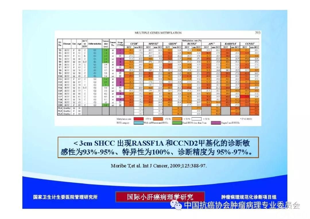 肿瘤病理诊断规范 第8部分:肝癌病理诊断规范