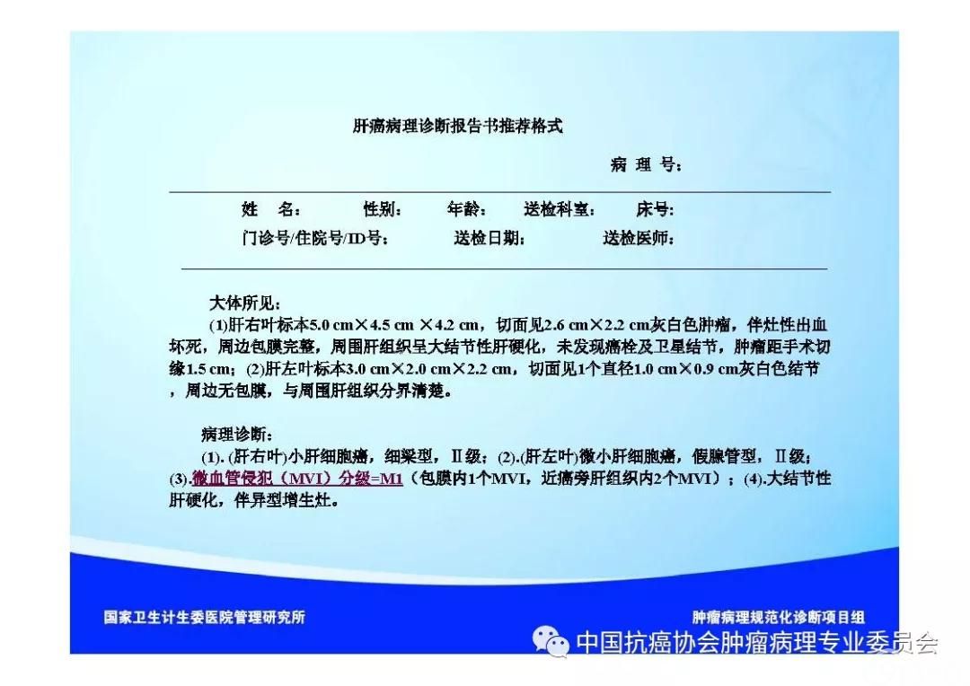 肿瘤病理诊断规范 第8部分:肝癌病理诊断规范