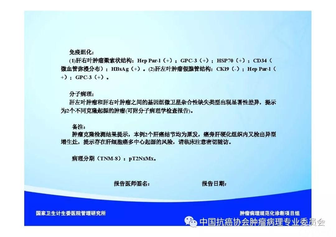 肿瘤病理诊断规范 第8部分:肝癌病理诊断规范