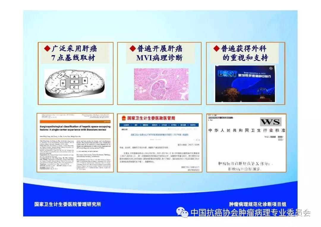 肿瘤病理诊断规范 第8部分:肝癌病理诊断规范