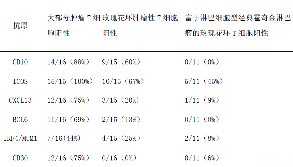 CD30在滤泡性T细胞淋巴瘤的肿瘤性T细胞表达是霍奇金淋巴瘤鉴别诊断中一种有帮助的诊断工具