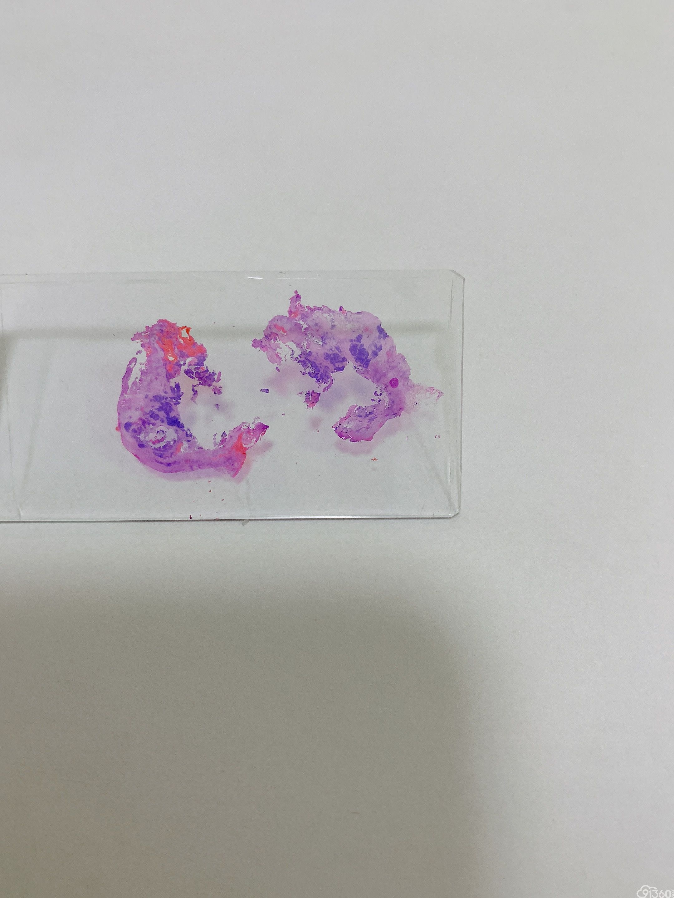 手绘病理世界——《锦鲤》