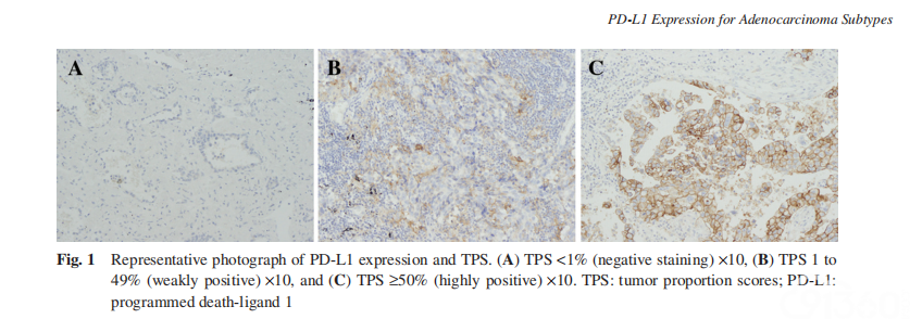 非小细胞肺癌及各亚型腺癌中PD-L1蛋白在的表达
