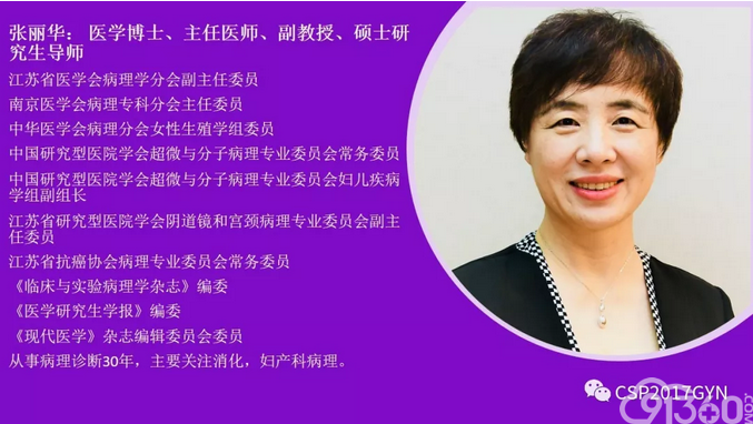 张丽华