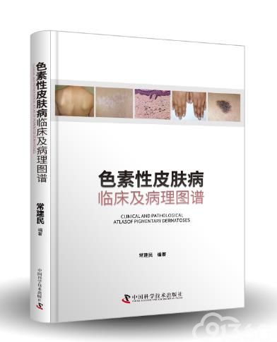 【新书上线】《色素性皮肤病：临床及病理图谱》，一窥疾病的内在奥秘！